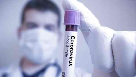 Rise In Deaths Due To Corona Virus In India
